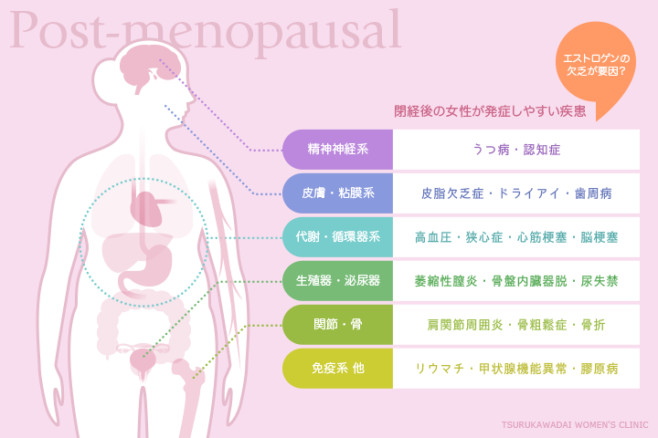 エストロゲンレベルが高くなる原因は何ですか?