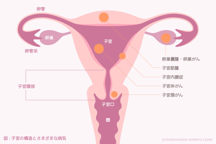 子宮の構造とさまざまな病気
